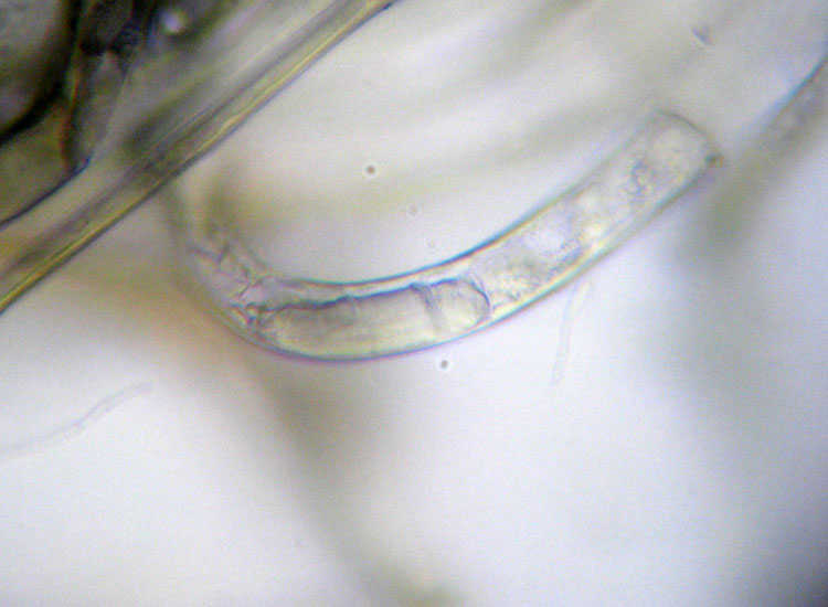 Patologia vegetale, fungo, myxo...?
